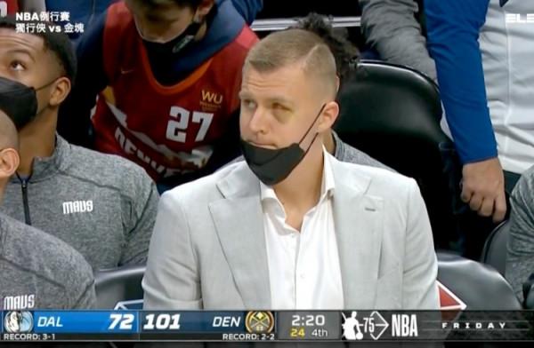 波爾津吉斯場邊觀戰 左眼淤青異常腫脹