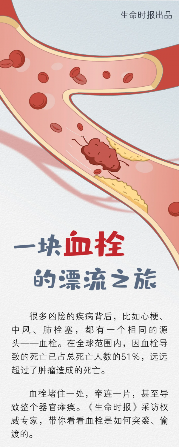 一塊「血栓」的危險漂流之旅 一塊「血栓」的危險漂流之旅