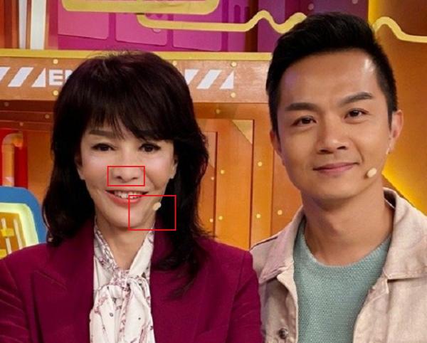 10位“整容上癮”的女星，明知矽膠臉恐怖，為何還是前仆後繼？