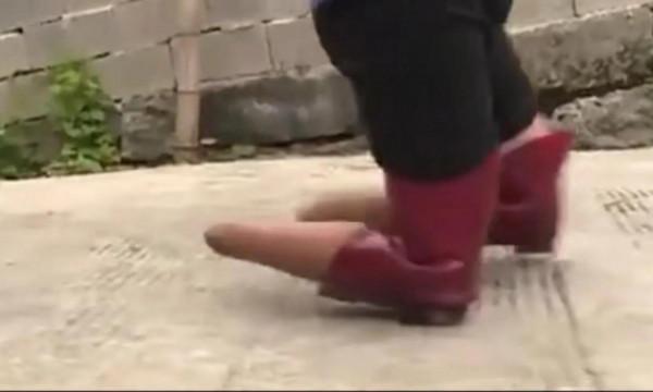 他因一次打架精神失常，離家時四肢健全，回家時雙腳已被卸下