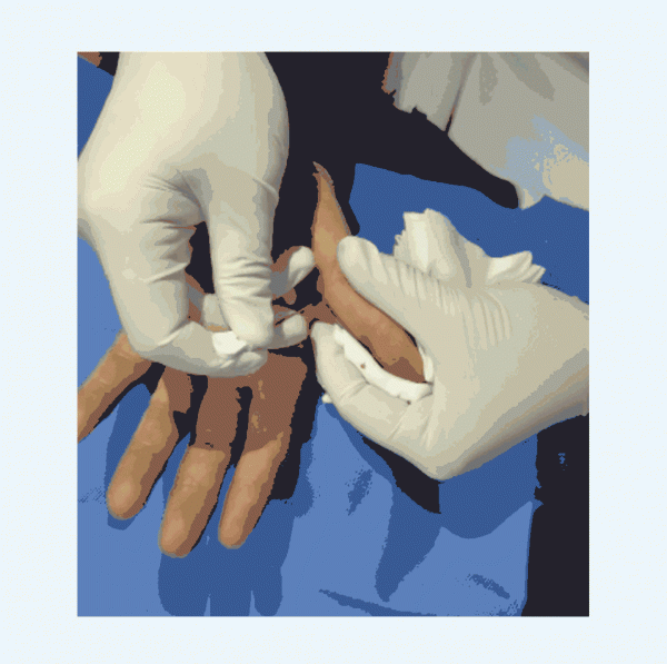 3步自測：你的手是不是“病”了？