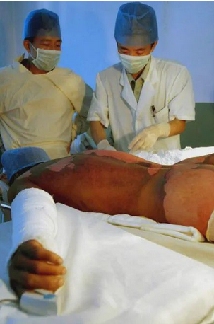 2003年工人挖出5個日軍遺留鐵桶，致1死43中毒，日本賠了多少錢？