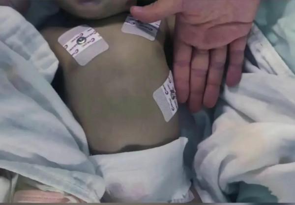 家長用熬煮的蔬菜水衝奶粉導致新生兒中毒,值得家長深思 家長用熬煮的蔬菜水衝奶粉導致新生兒中毒,值得家長深思