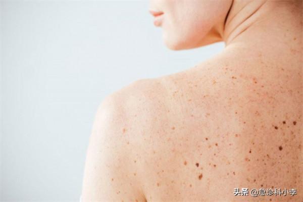 身上出現很多小紅點，不痛不癢是怎麼回事？聽聽醫生怎麼說