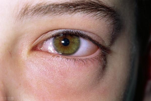 腎不好的人，晨起後會有4種表現