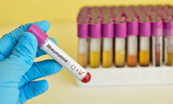 更好地控制類風溼,定期檢查很重要,尤其是這5項 更好地控制類風溼,定期檢查很重要,尤其是這5項