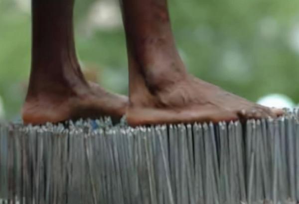 生啃手指，徒手拔牙，戳瞎眼睛，沒有疼痛的世界究竟有多可怕？