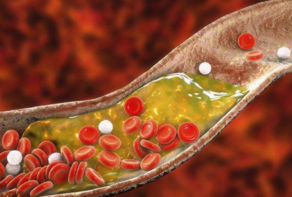 長期口服阿司匹林腸溶片和阿託伐他汀鈣會怎樣？有何注意事項？