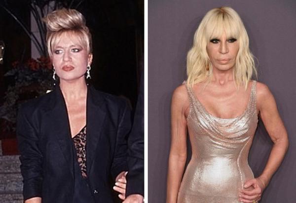 在轉向整形外科手術之前，10位明星真實的樣子，簡直面目全非