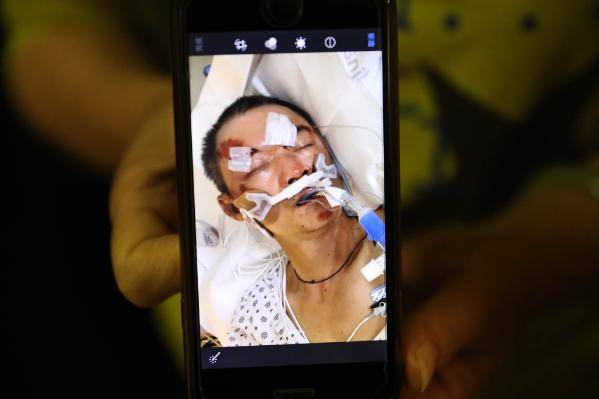 認定為殺人案!美國61歲華人男子撿易拉罐遇襲,因傷勢過重死亡 認定為殺人案!美國61歲華人男子撿易拉罐遇襲,因傷勢過重死亡