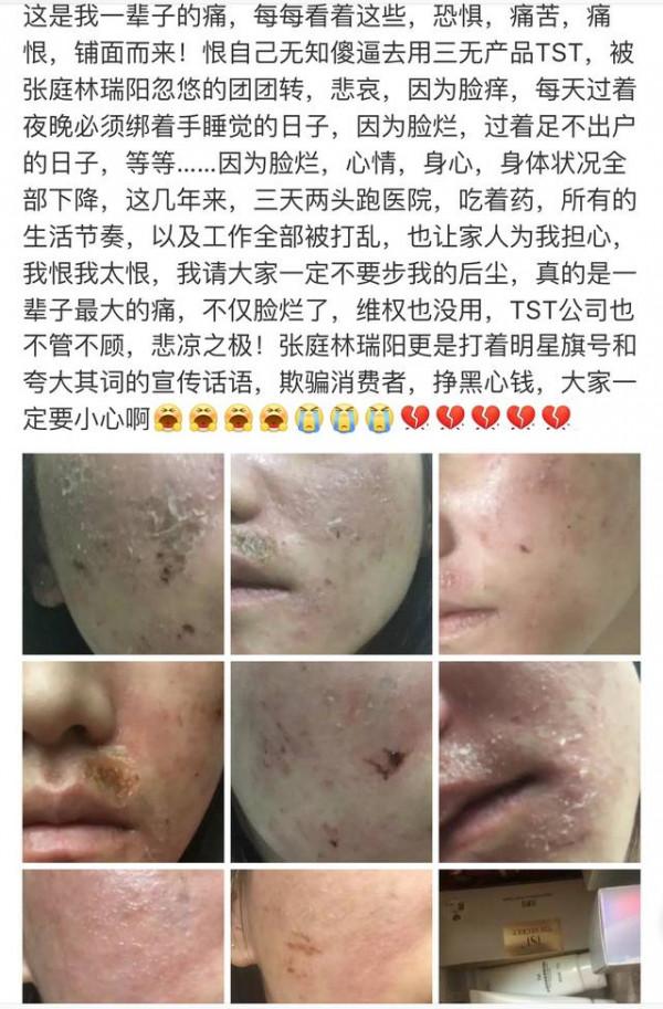 心不黑怎麼搞傳銷？粉絲爛臉，這兩口子爛心