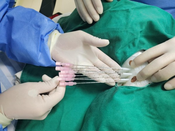 廣西首例！惡性腫瘤患者的福音