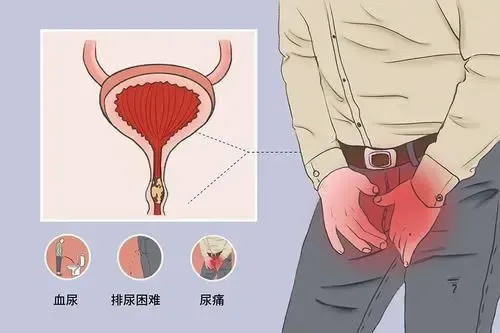 有些“肚子疼”延誤不得，你需要了解這些知識