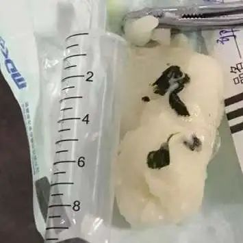 年糕也兇險！老人吃了口早飯就倒地昏迷