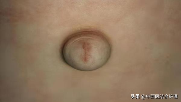 「中醫養生科普」低頭看看肚臍,都出現了什麼特徵,又代表了什麼? 「中醫養生科普」低頭看看肚臍,都出現了什麼特徵,又代表了什麼?