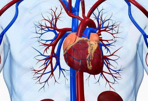 心梗發作之前，或有多次預兆，大家一定要引起重視，早了解早受益