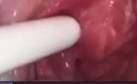 如果您也有口臭，正在被口臭困擾，請耐心看完這篇文章