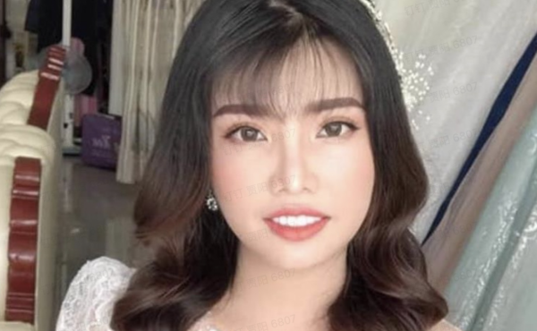 網路紅人鳳姐花3億越南盾整容美出新高度,嫁給富二代後過得如何 網路紅人鳳姐花3億越南盾整容美出新高度,嫁給富二代後過得如何