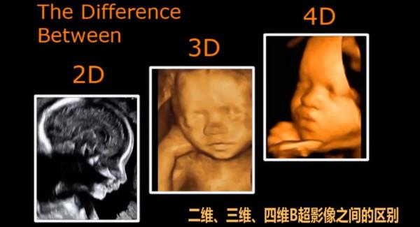 ​孕中期產檢:重要專案及檢查時間,關乎母子健康,一次都別落下 ​孕中期產檢:重要專案及檢查時間,關乎母子健康,一次都別落下