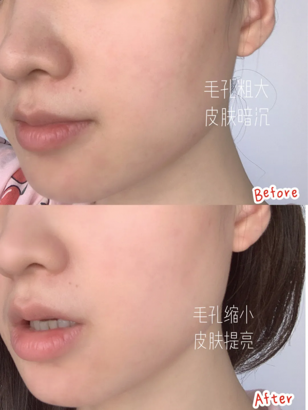 雅詩蘭黛紅石榴泡沫洗面奶，即是潔面乳也是面膜