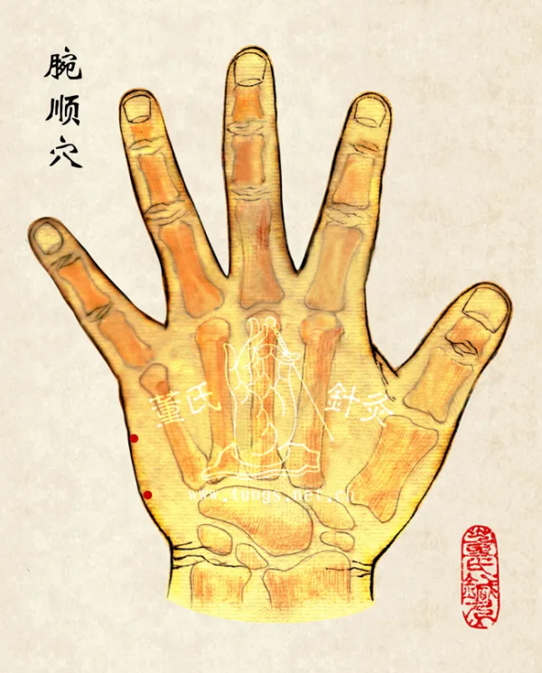 董氏奇穴治療“閃腰”經驗方