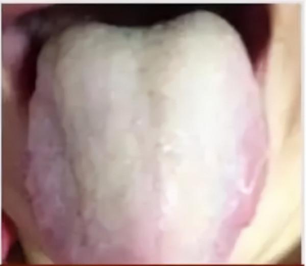 痰在哪兒,病就在哪兒,3味藥祛痰溼,痰溼沒了,咳喘也好了 痰在哪兒,病就在哪兒,3味藥祛痰溼,痰溼沒了,咳喘也好了