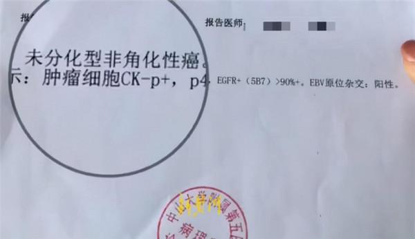 24歲女生抗癌一年：做3次化療30多次放療 脖子潰爛