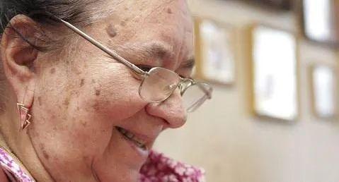 為什麼會出現老年斑?有辦法預防改善或去除嗎?不妨詳細瞭解一下 為什麼會出現老年斑?有辦法預防改善或去除嗎?不妨詳細瞭解一下