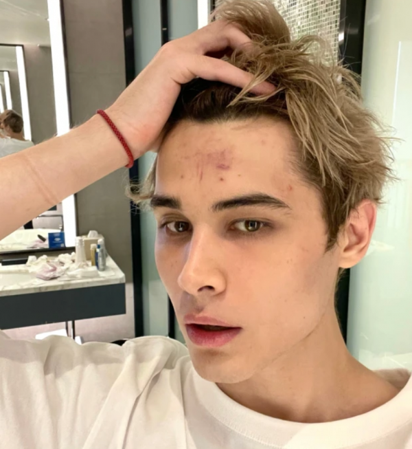 高以翔之後,又一位男星因參與綜藝的錄製,被救護車拉走 高以翔之後,又一位男星因參與綜藝的錄製,被救護車拉走