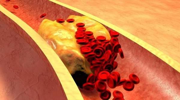 患上高血糖,該喝牛奶還是豆漿?或不用糾結了解一下 患上高血糖,該喝牛奶還是豆漿?或不用糾結了解一下