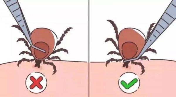 【衛生檢疫】草爬子的自述