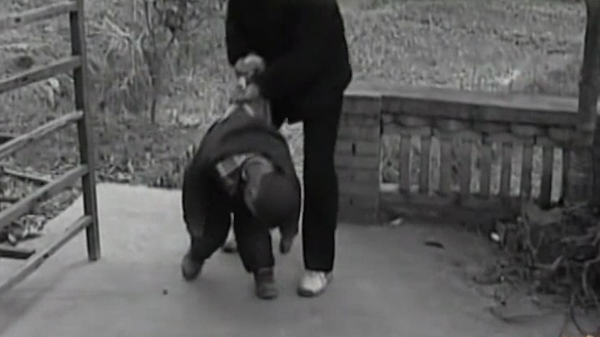 有人長六根手指，有人長兩顆腦袋，但你聽過人的頭上可以長貝殼嗎