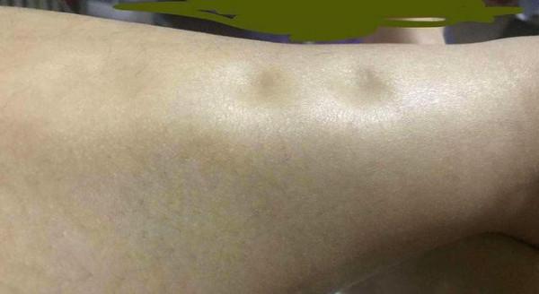 身體出現4個跡象，或說明你吃的“鹽”太多了！趕緊控制起來