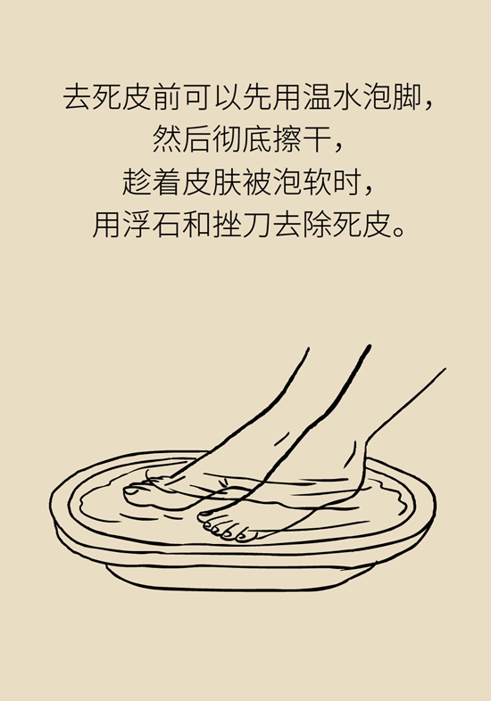 長了雞眼和老繭怎麼辦？這份防治指南請收好