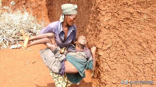 非洲腦癱夫妻結婚27年,每天嘴對嘴餵飯給丈夫,愛情和金錢無關 非洲腦癱夫妻結婚27年,每天嘴對嘴餵飯給丈夫,愛情和金錢無關