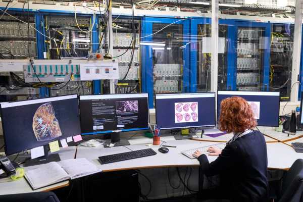 他們用人類史上最強的X光，告訴我們新冠患者的肺傷成了什麼樣