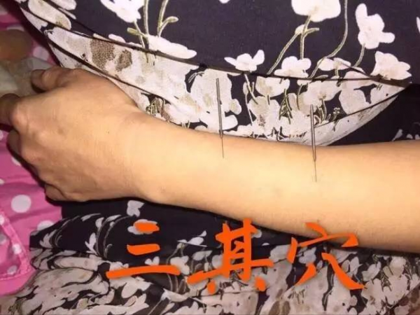 便秘可以透過針灸搞定嗎？值得收藏