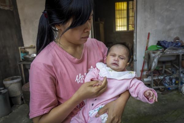 女嬰出生時體重僅3斤8兩,母親盼到孩子出院卻發現她眼睛不對勁 女嬰出生時體重僅3斤8兩,母親盼到孩子出院卻發現她眼睛不對勁