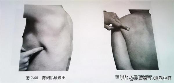 肩部疼痛的觸診圖解（很珍貴資料），值得一看
