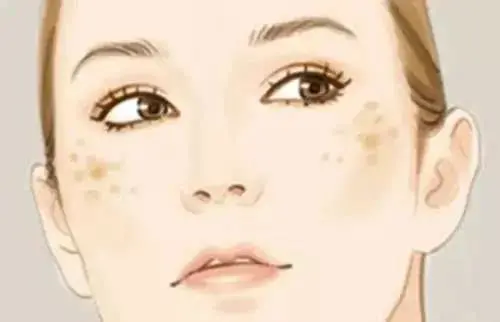 別踩雷啦,安全有效的美白淡斑攻略在這 別踩雷啦,安全有效的美白淡斑攻略在這