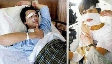 5位“毀容”的明星,胡歌“鬼門關”逃了出來,王心凌令人惋惜 5位“毀容”的明星,胡歌“鬼門關”逃了出來,王心凌令人惋惜