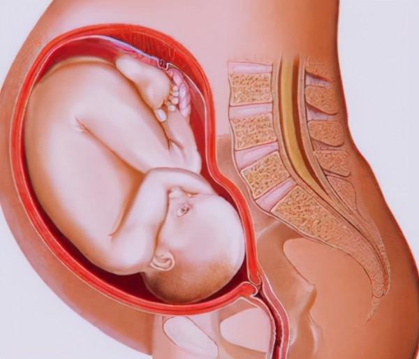 產後腰痛，是&OpenCurlyDoubleQuote;月子&rdquo;沒坐好嗎？醫生分享3種方法，有效預防