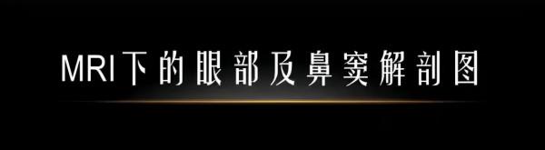 MRI下眼部及鼻竇解剖