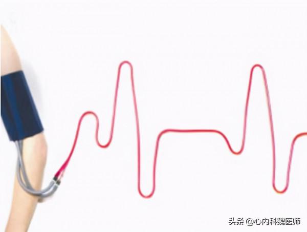 54歲男子血壓在145/95,屬於高血壓嗎? 54歲男子血壓在145/95,屬於高血壓嗎?