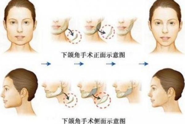 “假臉”大比拼?薛之謙變化大、羅志祥五官前後對比驚人 “假臉”大比拼?薛之謙變化大、羅志祥五官前後對比驚人