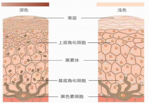 為什麼愛喝酒的人，容易得腦梗塞？這4個原因是關鍵