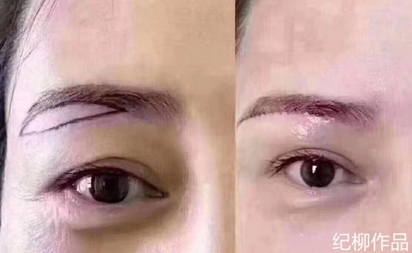 為什麼天生的雙眼沒有了？解讀消失的雙眼皮