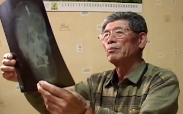 故事:韓國60歲大叔出車禍,檢查發現脖內有子彈,為何40年毫無察覺