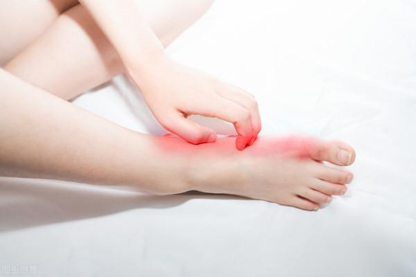 冬天手腳乾燥，腳後跟也容易乾裂？做好這4件事，或許能緩解問題