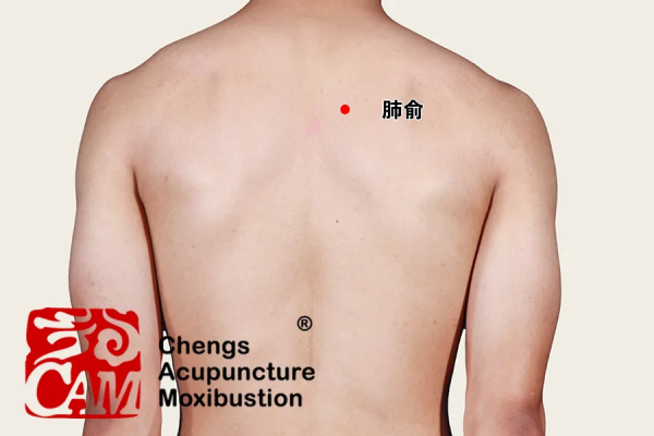 預防溼疹，蕁麻疹，這些問題都可以用拔罐的方法解決